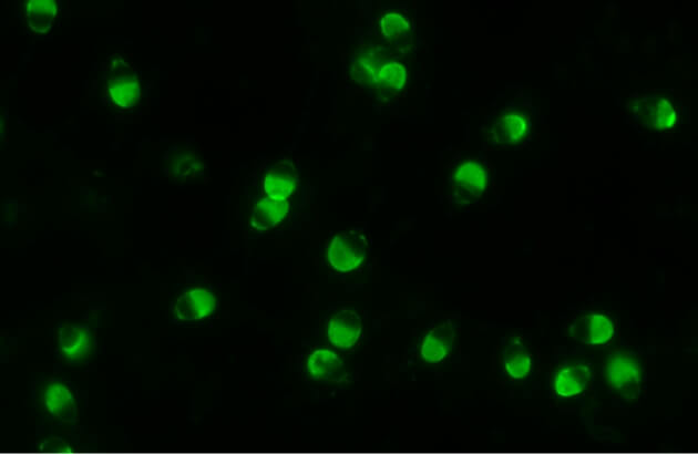 図3 先体反応を起こすことができた精子の蛍光染色像